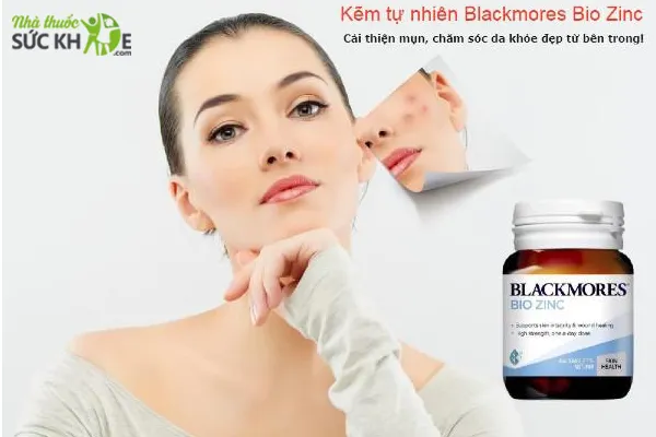 Vi&ecirc;n bổ sung kẽm tự nhi&ecirc;n Blackmores Bio ZinC