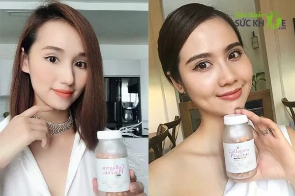 Collagen trắng da tốt nhất hiện nay Placenta