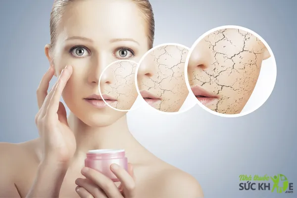 Dưỡng ẩm giúp ngăn ngừa tình trạng da thiếu nước, tiết nhiều dầu