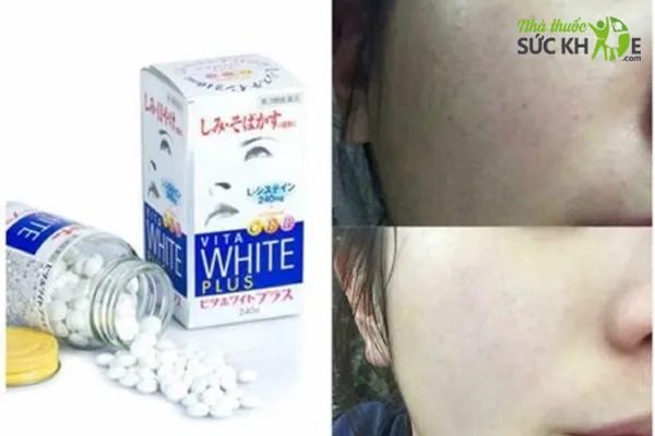 Vi&ecirc;n uống trắng da chống nắng Vita White Plus